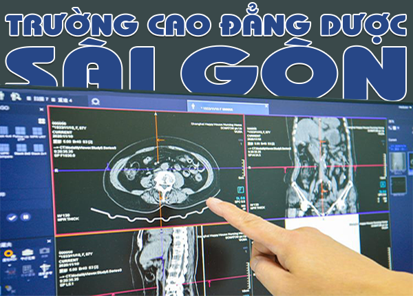 Học phí Trường Cao đẳng Kỹ thuật hình ảnh Y học Sài Gòn