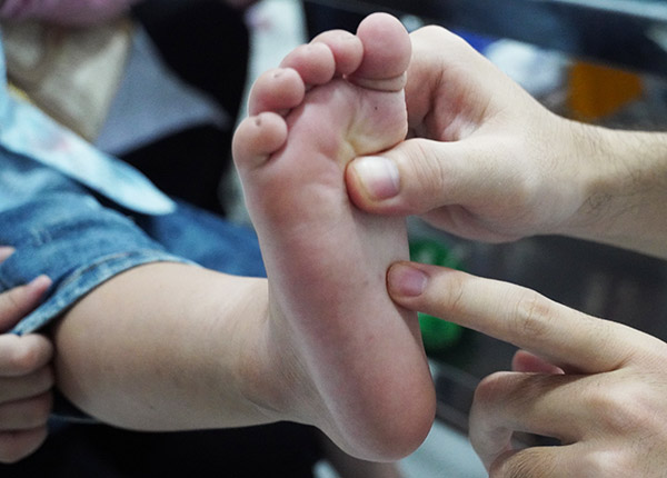Lưu ý phòng bệnh cho trẻ khi xuất hiện ổ dịch tay chân miệng