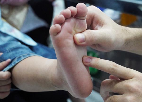 Lưu ý phòng bệnh cho trẻ khi xuất hiện ổ dịch tay chân miệng