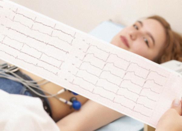 Nhận diện các dấu hiệu nhồi máu cơ tim qua điện tâm đồ (ECG)